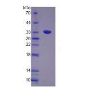 SDS-PAGE analysis of recombinant Human Utrophin Protein.