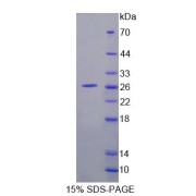 SDS-PAGE analysis of ADAMTS9 Protein.