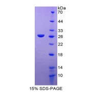 SDS-PAGE analysis of recombinant Human Reelin Protein.