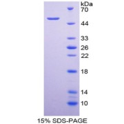 SDS-PAGE analysis of IL28A Protein.