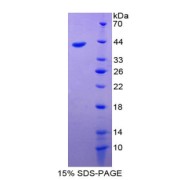 SDS-PAGE analysis of Villin 1 Protein.