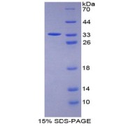 SDS-PAGE analysis of Signal Transducing Adaptor Molecule 1 Protein.