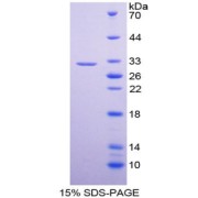 SDS-PAGE analysis of recombinant Human L-Dopachrome Tautomerase (DCT) Protein.