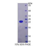 SDS-PAGE analysis of recombinant Human Lysine Specific Demethylase 4A Protein.