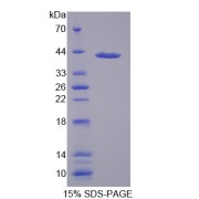 SDS-PAGE analysis of Methylenetetrahydrofolate Reductase Protein.