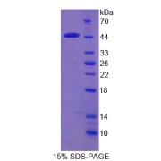 SDS-PAGE analysis of ACAT2 Protein.