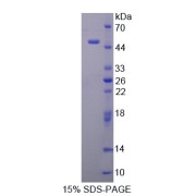 SDS-PAGE analysis of Smoothelin Protein.