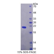 SDS-PAGE analysis of Endothelin 2 Protein.