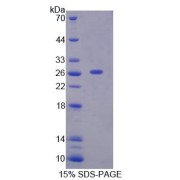 SDS-PAGE analysis of Proteasome Subunit alpha Type 7 Protein.