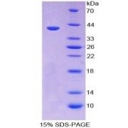 SDS-PAGE analysis of Keratin 14 Protein.