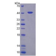 SDS-PAGE analysis of Carboxypeptidase A4 Protein.