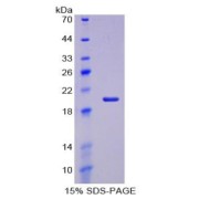 SDS-PAGE analysis of Aggrecan Protein.