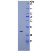 SDS-PAGE analysis of recombinant Human Tenascin C Protein.
