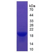 SDS-PAGE analysis of Vitronectin Protein.