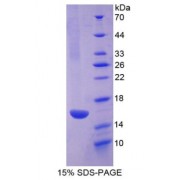 SDS-PAGE analysis of RSPO1 Protein.