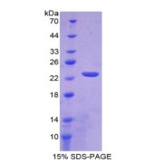 SDS-PAGE analysis of IL1Z Protein.