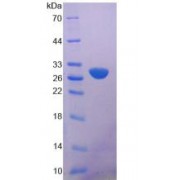 SDS-PAGE analysis of Phospholipase A2, Calcium Independent Protein.