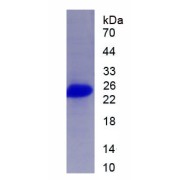 SDS-PAGE analysis of recombinant Human Placental Lactogen Protein.