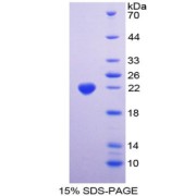 SDS-PAGE analysis of Alanine Aminopeptidase Protein.