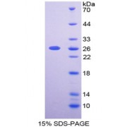SDS-PAGE analysis of Extracellular Matrix Metalloproteinase Inducer Protein.