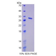 SDS-PAGE analysis of Taxilin alpha Protein.