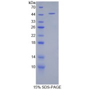 SDS-PAGE analysis of Hemoglobin beta Protein.