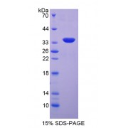 SDS-PAGE analysis of Serum/Glucocorticoid Regulated Kinase 2 Protein.