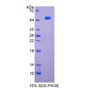 SDS-PAGE analysis of Enolase, Muscle Specific Protein.