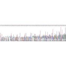 Human Kallikrein 2 (KLK2) Protein