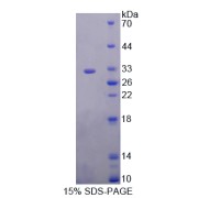 SDS-PAGE analysis of recombinant Human Kallikrein 2 Protein.