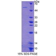 SDS-PAGE analysis of Glutathione Reductase Protein.