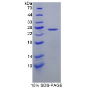 SDS-PAGE analysis of Calcyphosine Protein.