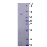 SDS-PAGE analysis of Glutamate Carboxypeptidase II Protein.