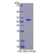 SDS-PAGE analysis of Proteasome Subunit beta Type 6 Protein.