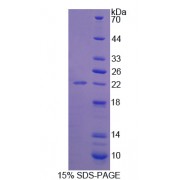 SDS-PAGE analysis of recombinant Human Contactin 2 Protein.