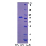 SDS-PAGE analysis of Chymotrypsinogen B1 Protein.