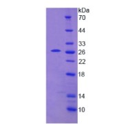 SDS-PAGE analysis of Thiopurine Methyltransferase Protein.