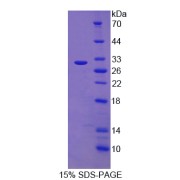 SDS-PAGE analysis of Proteasome Subunit alpha Type 1 Protein.