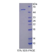 SDS-PAGE analysis of Activin A Receptor Type I C Protein.