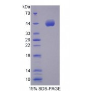 SDS-PAGE analysis of recombinant Human  5-Methyltetrahydrofolate Homocysteine Methyltransferase Protein.