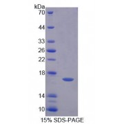 SDS-PAGE analysis of Fatty Acid Desaturase 3 Protein.