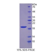 SDS-PAGE analysis of Nuclear Distribution Gene C Homolog Protein.