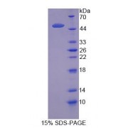 SDS-PAGE analysis of Solute Carrier Family 1, Member 5 Protein.