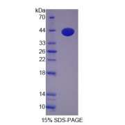 SDS-PAGE analysis of Kinesin light chain 1 Protein.