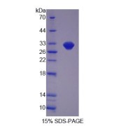 SDS-PAGE analysis of Lactamase beta Protein.