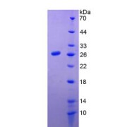 SDS-PAGE analysis of recombinant Human Prolactin Protein.