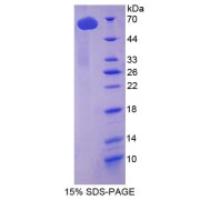 SDS-PAGE analysis of Tubulin delta Protein.