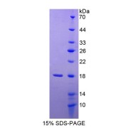 SDS-PAGE analysis of MAN2B1 Protein.