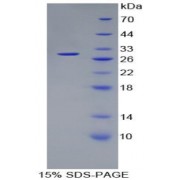 SDS-PAGE analysis of Proteasome 26S Subunit, Non ATPase 10 Protein.