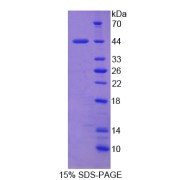 SDS-PAGE analysis of Apoptosis Inhibitor 5 Protein.